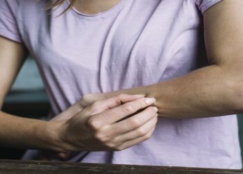 Dermatographia: Gejala, Penyebab, dan Pengobatan