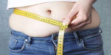 8 Cara Alami Mengecilkan Perut setelah Operasi Caesar