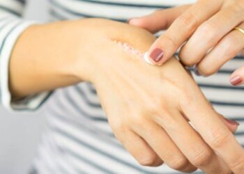 10 Manfaat Vitamin E untuk Kulit Wajah dan Tubuh