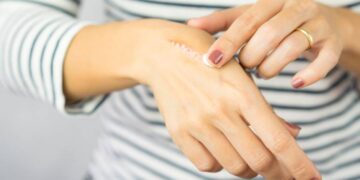 10 Manfaat Vitamin E untuk Kulit Wajah dan Tubuh