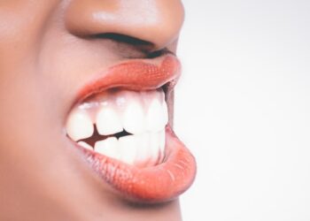 Abses Gigi: Pengertian, Gejala, Penyebab, dan Pengobatan