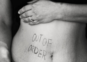 Ambeien (Wasir): Gejala, Penyebab, dan Pengobatan