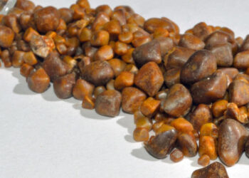 Batu Empedu: Gejala, Penyebab, dan Pengobatan