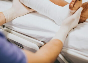 Edema: Gejala, Penyebab, Pengobatan, dan Pencegahan