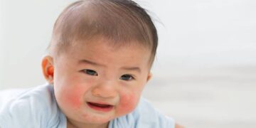 10 Rekomendasi Produk Perawatan Kulit Bayi Sensitif