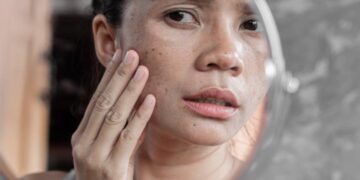 kulit rusak akibat stres farmaku