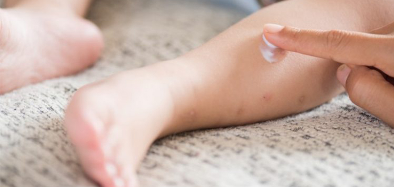 dermatitis kontak pada bayi farmaku