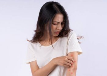 obat kurap di apotik yang paling ampuh