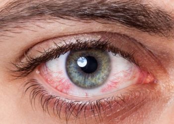 gambar Cendo untuk Infeksi Mata