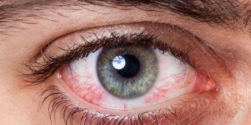 gambar Cendo untuk Infeksi Mata