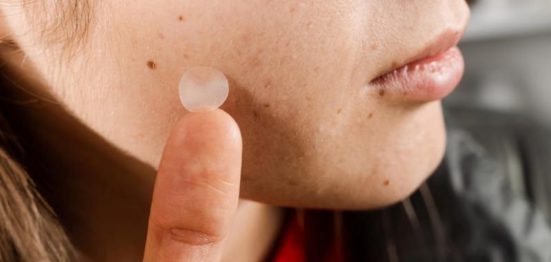 gambar acne patch derma angel