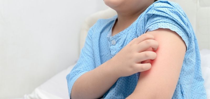Obat Alergi Anak di Apotek yang Manjur untuk Meredakan Gejala