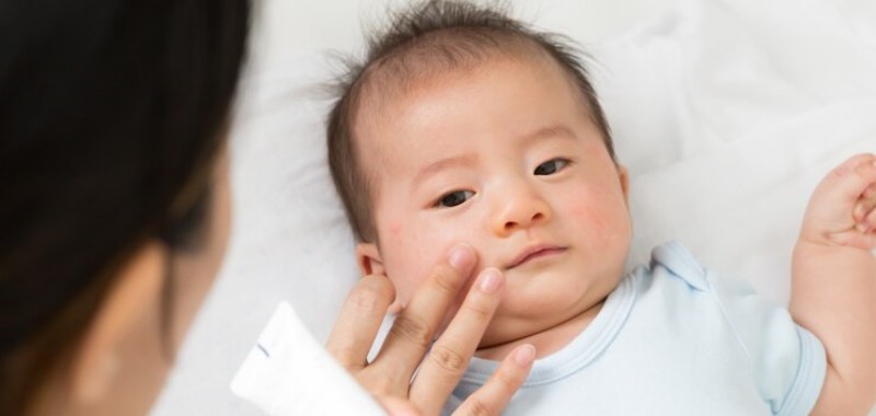 gambar krim wajah bayi