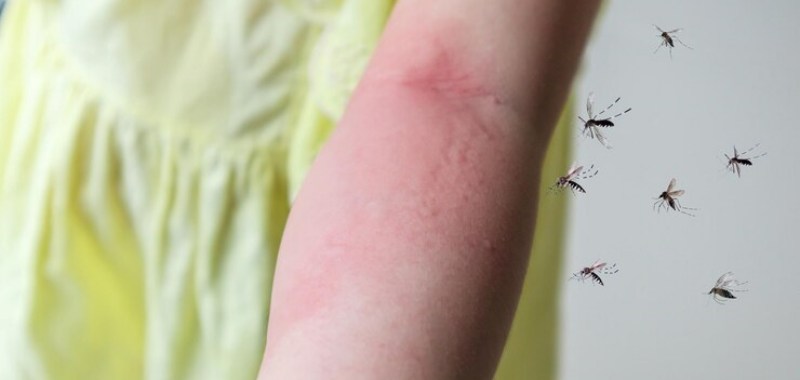 gambar obat bekas gigitan jerawat